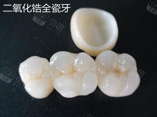 二氧化锆全瓷牙价格表,与自然美景对话,探寻内心宁静之旅